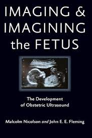 Book Review: Imaging and Imagining the Fetus–The Development of Obstetric Ultrasound