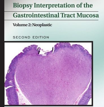 Book Review: Biopsy Interpretation of the Gastrointestinal Tract Mucosa, 2nd edition, Volume 2: Neoplastic