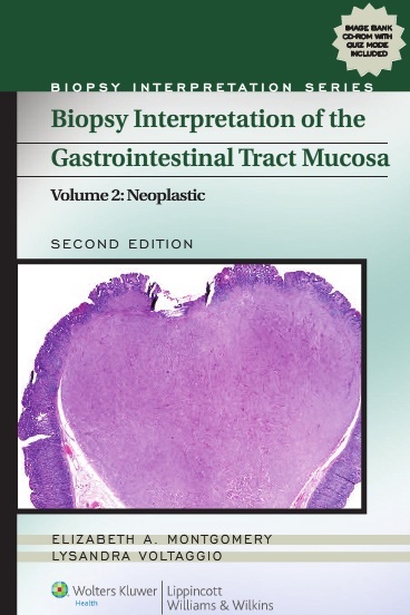 Book Review: Biopsy Interpretation of the Gastrointestinal Tract Mucosa, 2nd edition, Volume 2: Neoplastic