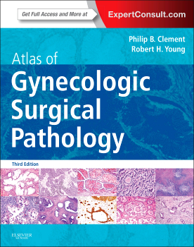 Book Review: Atlas of Gynecologic Surgical Pathology, 3rd edition