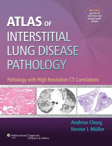 Book Review: Atlas of Interstitial Lung Disease Pathology – Pathology with High Resolution CT Correlations