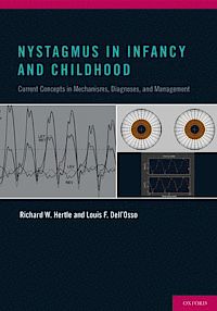 Book Review: Nystagmus in Infancy and Childhood