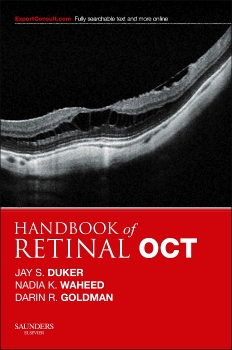 Book Review: Handbook of Retinal OCT