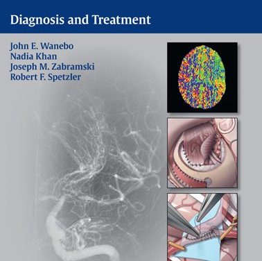 Book Review: Moyamoya Disease: Diagnosis and Treatment