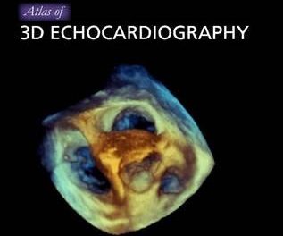 Book Review: Atlas of 3D Echocardiography