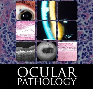 Book Review: Ocular Pathology, 7th edition