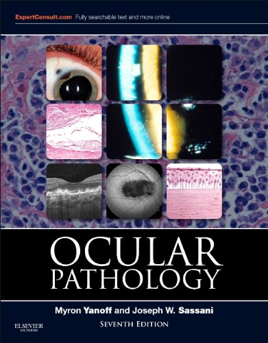 Book Review: Ocular Pathology, 7th edition