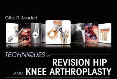 Book Review: Techniques in Revision Hip and Knee Arthroplasty