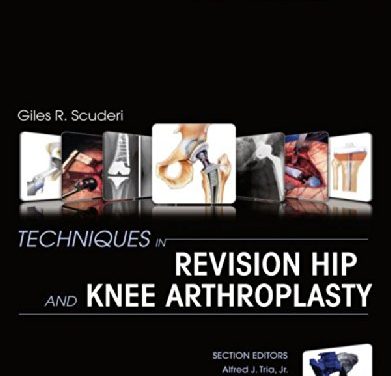 Book Review: Techniques in Revision Hip and Knee Arthroplasty