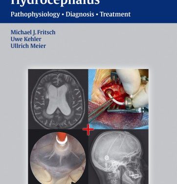 Book Review: Normal Pressure Hydrocephalus – Pathophysiology, Diagnosis, Treatment