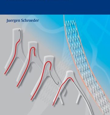 Book Review: Peripheral Vascular Interventions – An Illustrated Manual