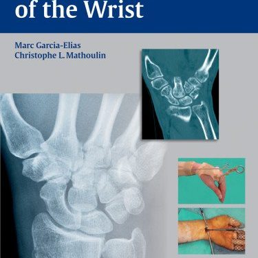 Book Review: Articular Injury of the Wrist – FESSH 2014 Instructional Course Book