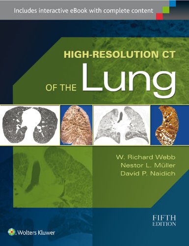 Book Review: High-Resolution CT of the Lung, 5th edition