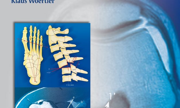 Book Review: Measurements and Classifications in Musculoskeletal Radiology