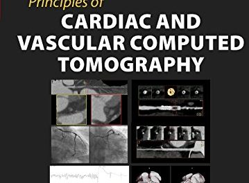 Book Review: Principles of Cardiac and Vascular Computed Tomography