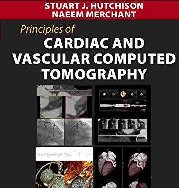 Book Review: Principles of Cardiac and Vascular Computed Tomography