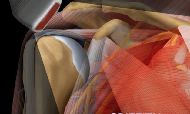 Book Review: Diagnostic Ultrasound – Musculoskeletal