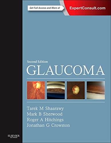 Book Review: Glaucoma, 2nd edition (Two-Volume Set)
