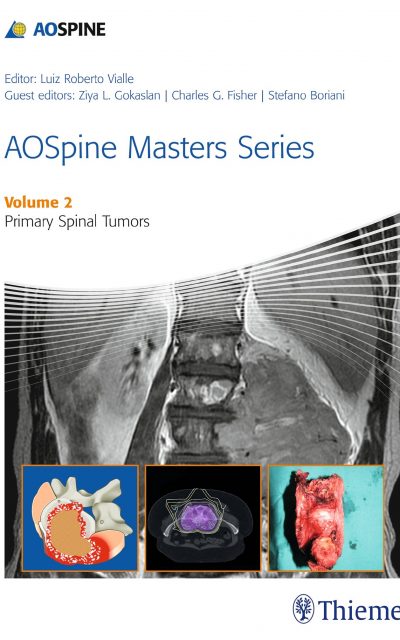 Book Review: Primary Spinal Tumors, Volume 2 (Part of the AOSpine Masters Series)