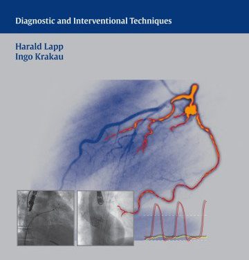 Book Review: The Cardiac Catheter Book – Diagnostic and Interventional Techniques