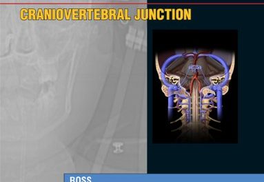 Book Review: Specialty Imaging: Craniovertebral Junction