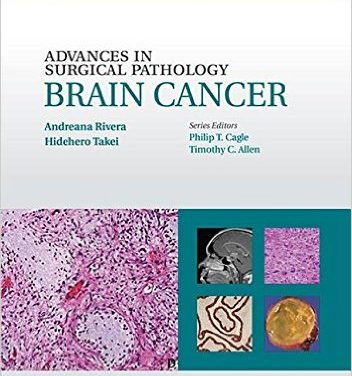 Book Review: Advances in Surgical Pathology: Brain Cancer