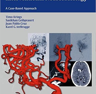 Book Review: Neurovascular Anatomy in Interventional Neuroradiology