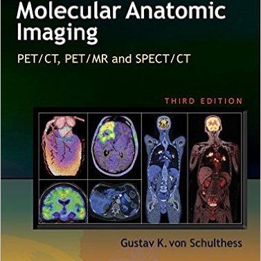 Book Review: Molecular Anatomic Imaging – PET/CT, PET/MR and SPECT/CT,  3rd edition