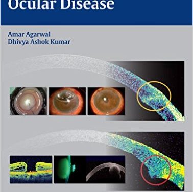 Book Review: Essentials of OCT in Ocular Disease