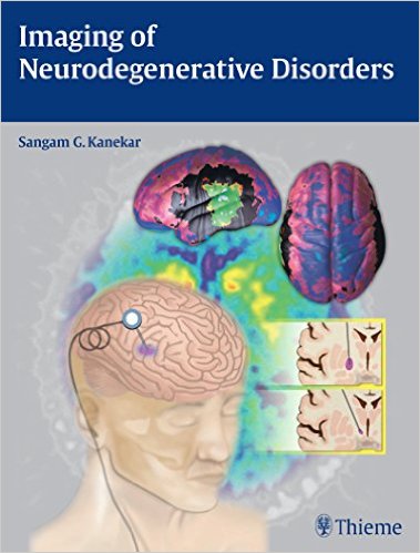 Book Review: Imaging of Neurodegenerative Disorders