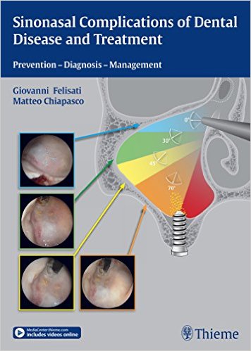 Book Review: Sinonasal Complications of Dental Disease and Treatment