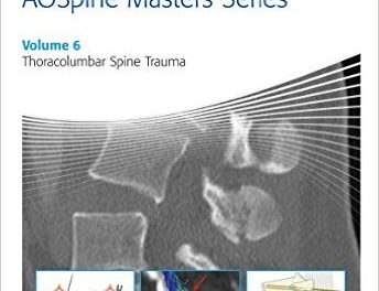 Book Review: Thoracolumbar Spine Trauma