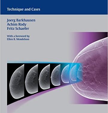 Book Review: Digital Breast Tomosynthesis: Technique and Cases