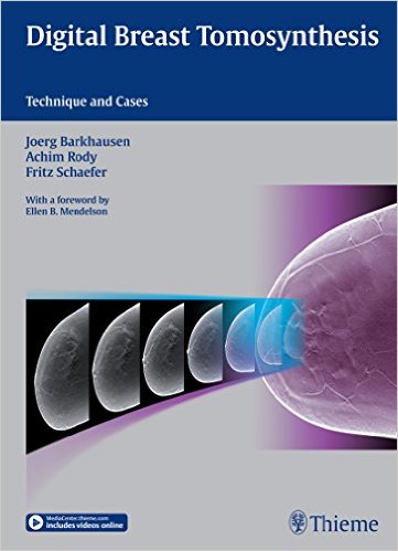 Book Review: Digital Breast Tomosynthesis: Technique and Cases