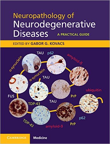 Book Review: Neuropathology of Neurodegenerative Diseases – A Practical Guide