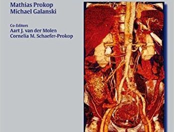 Book Review: Spiral and Multislice Computed Tomography