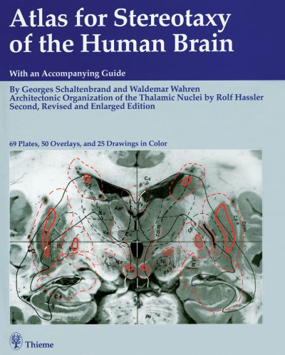 Book Review: Atlas for Stereotaxy of the Human Brain, 2nd edition, revised and enlarged