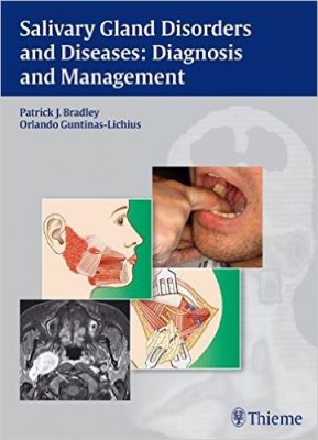 Salivary Gland Disorders and Diseases – Diagnosis and Management