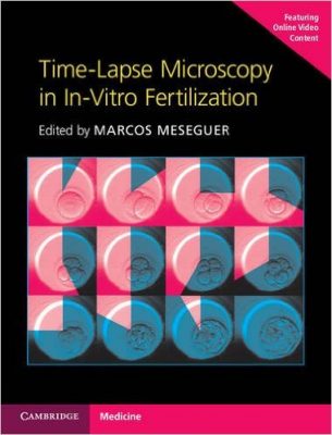 Time-Lapse Microscopy in In-Vitro Fertilization - Hardback with Online Resource