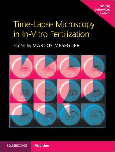 Book Review: Time-Lapse Microscopy in In-Vitro Fertilization