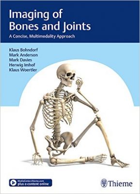 imaging-of-bones-and-joints-a-concise-multimodality-approach
