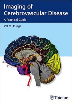 imaging-of-cerebrovascular-disease-a-practical-guide-1st-edition