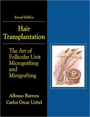 hair-transplantation-the-art-of-follicular-micrografting-and-minigrafting-2nd-edition