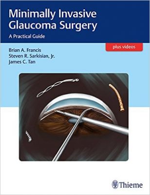 minimally-invasive-glaucoma-surgery-a-practical-guide