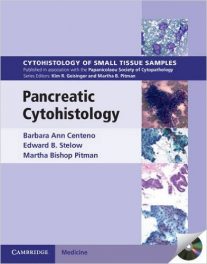 Book Review: Pancreatic Cystohistology