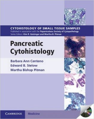 pancreatic-cytohistology-cytohistology-of-small-tissue-samples