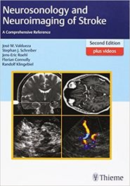 Book Review: Neurosonology and Neuroimaging of Stroke – A Comprehensive Reference, 2nd edition, plus videos