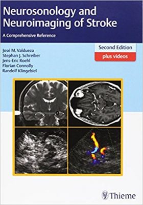 neurosonology-and-neuroimaging-of-stroke-a-comprehensive-reference-2nd-edition-plus-videos