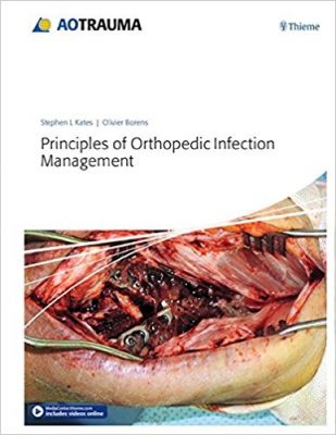 principles-of-orthopedic-infection-management