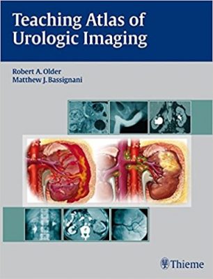 teaching-stlas-of-urologic-imaging